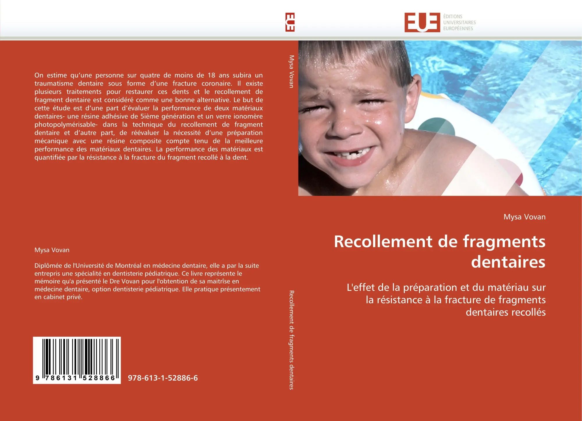 Recollement de fragments dentaires | L''effet de la préparation et du matériau sur la résistance à la fracture de fragments dentaires recollés | Mysa Vovan | Taschenbuch | Paperback | 132 S. | 2010 - Vovan, Mysa