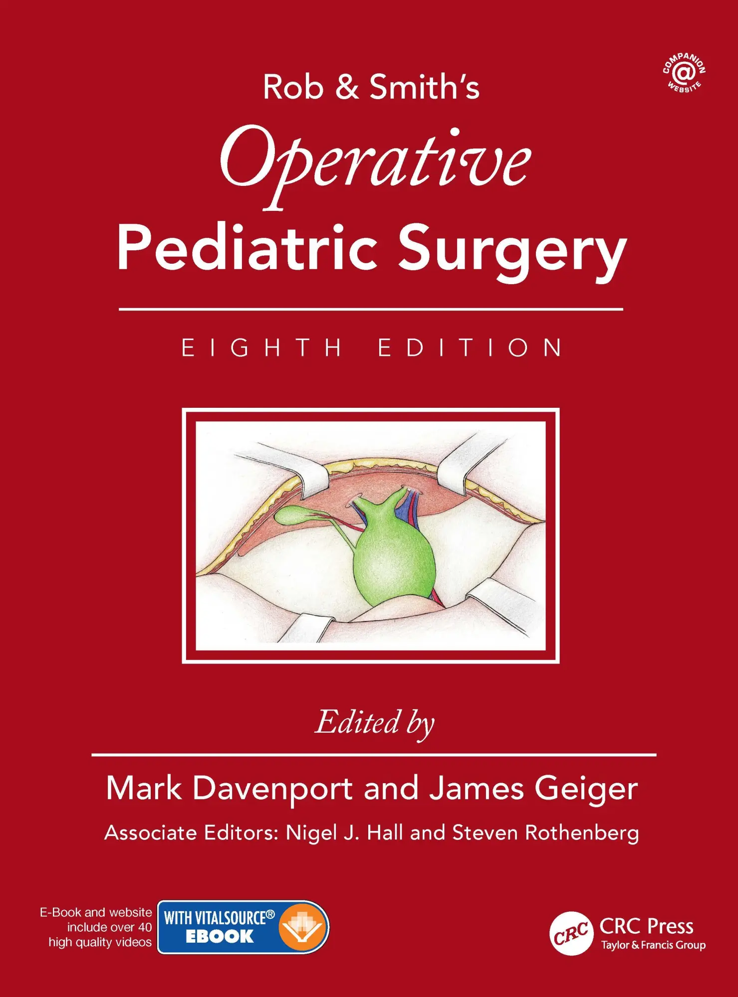 Cover: 9780815370000 | Operative Pediatric Surgery | Mark Davenport (u. a.) | Taschenbuch