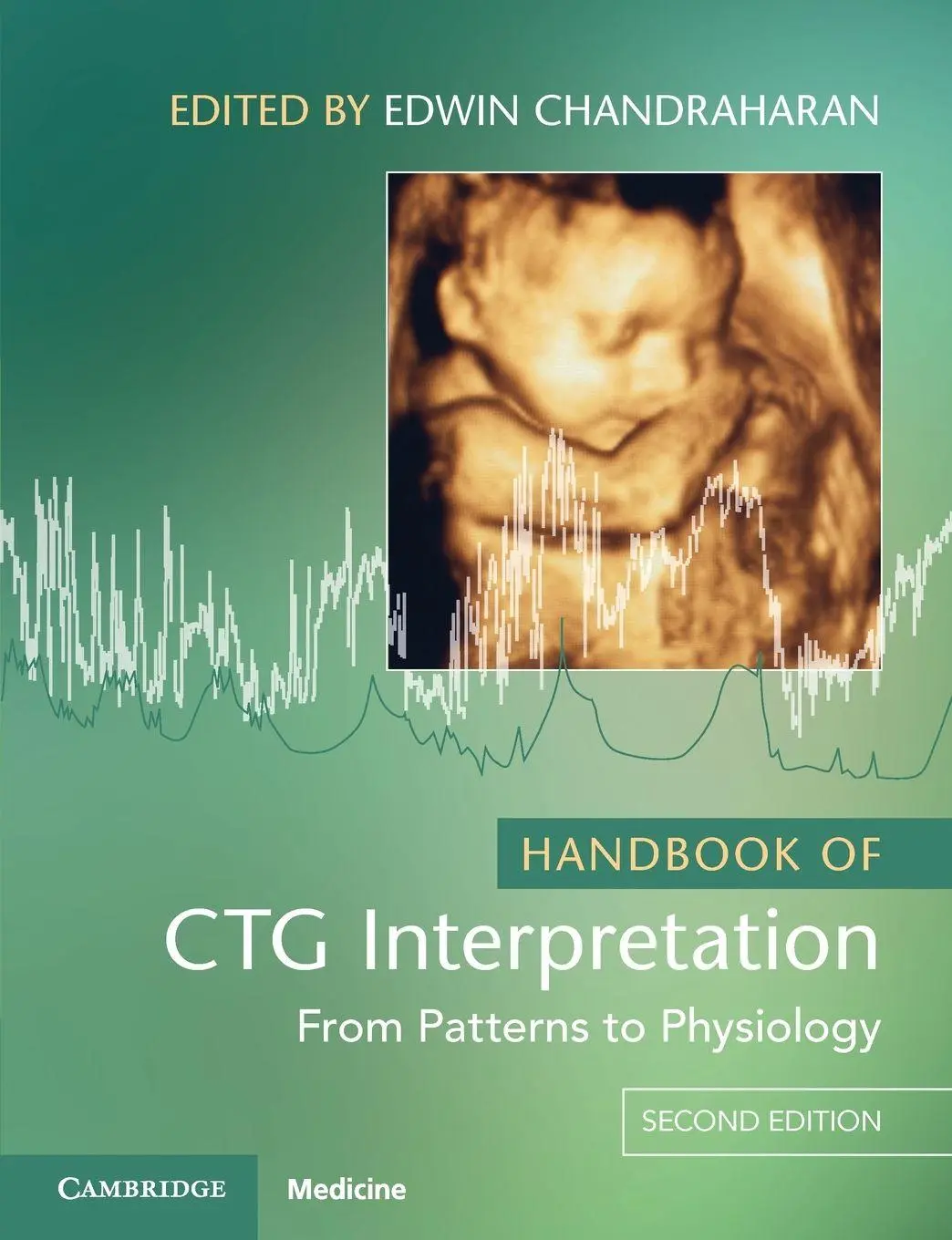 Cover: 9781009322300 | Handbook of CTG Interpretation | Edwin Chandraharan | Taschenbuch