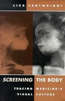 Cover: 9780816622900 | Screening the Body | Tracing Medicine's Visual Culture | Cartwright