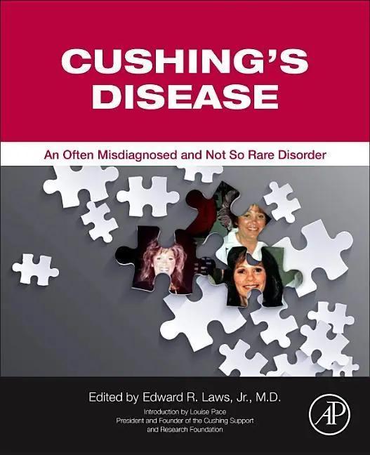Cover: 9780128043400 | Cushing's Disease | An Often Misdiagnosed and Not So Rare Disorder