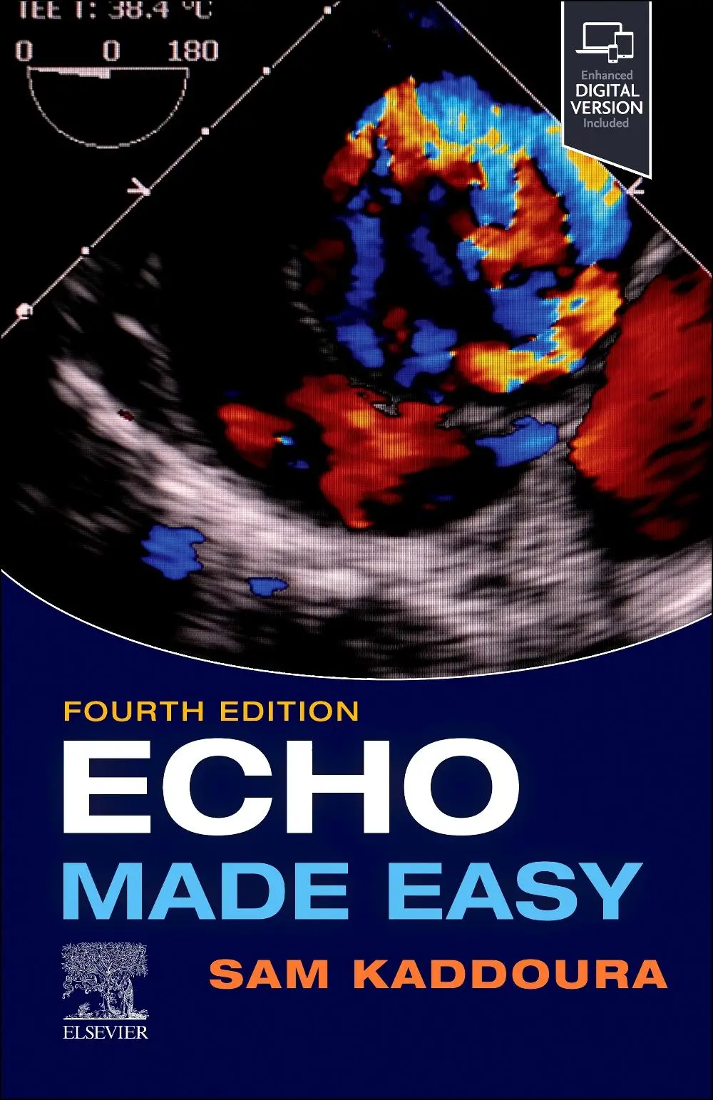 Cover: 9780702083600 | Echo Made Easy | Sam Kaddoura | Taschenbuch | Made Easy (Elsevier)