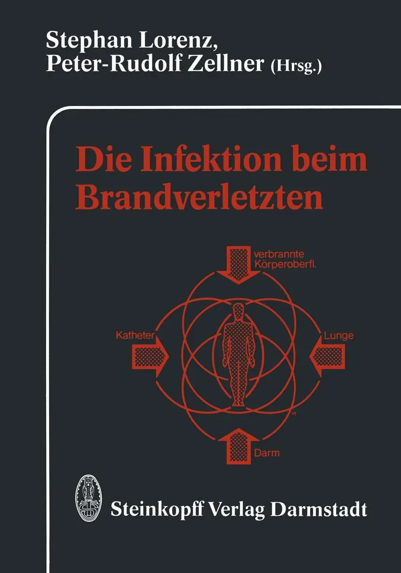Cover: 9783642854200 | Die Infektion beim Brandverletzten | S. Lorenz (u. a.) | Taschenbuch