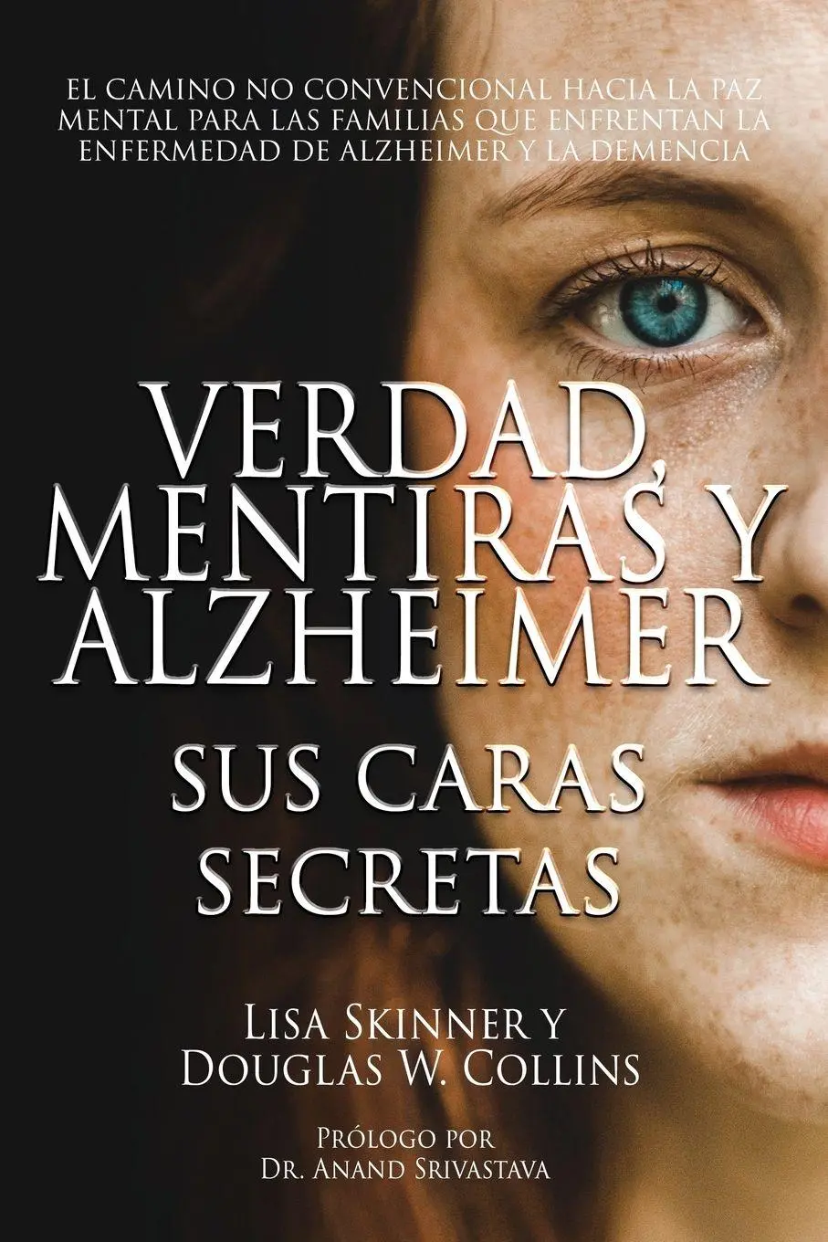 Cover: 9781957344300 | Verdad, Mentiras y Alzheimer | Sus Caras Secretas | Skinner (u. a.)