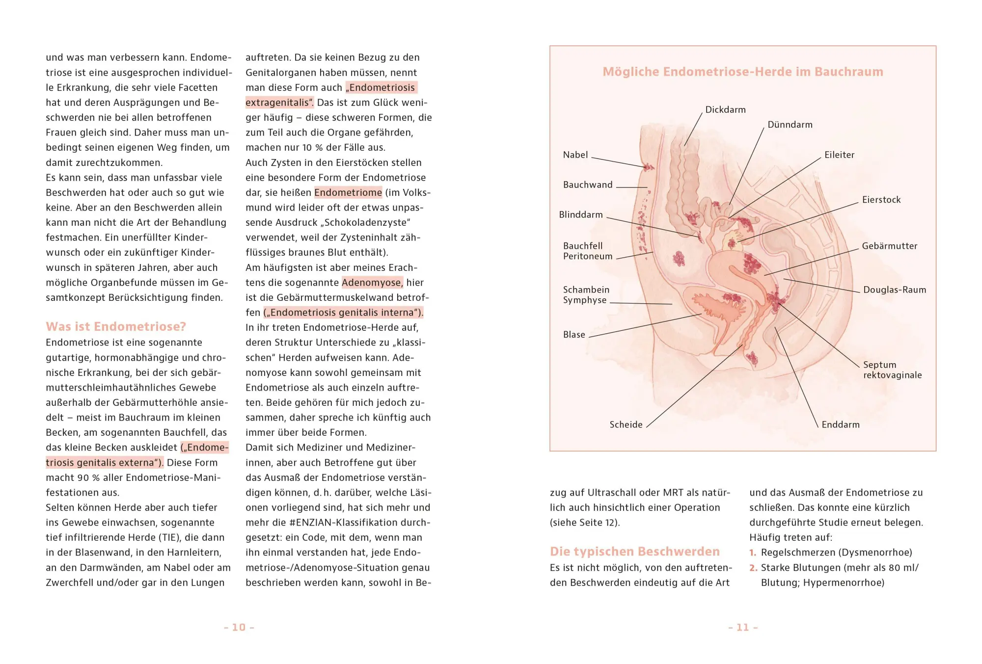 Bild: 9783965845800 | Endometriose - Was tun? | Sylvia Mechsner | Taschenbuch | 176 S. | ZS