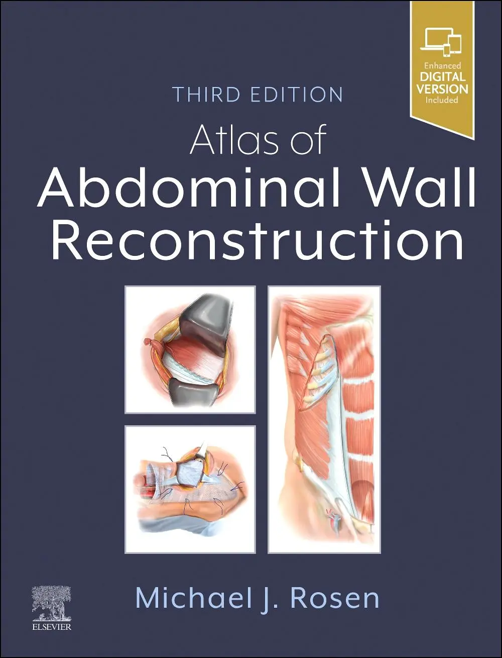 Cover: 9780443118500 | Atlas of Abdominal Wall Reconstruction | Michael J. Rosen | Buch