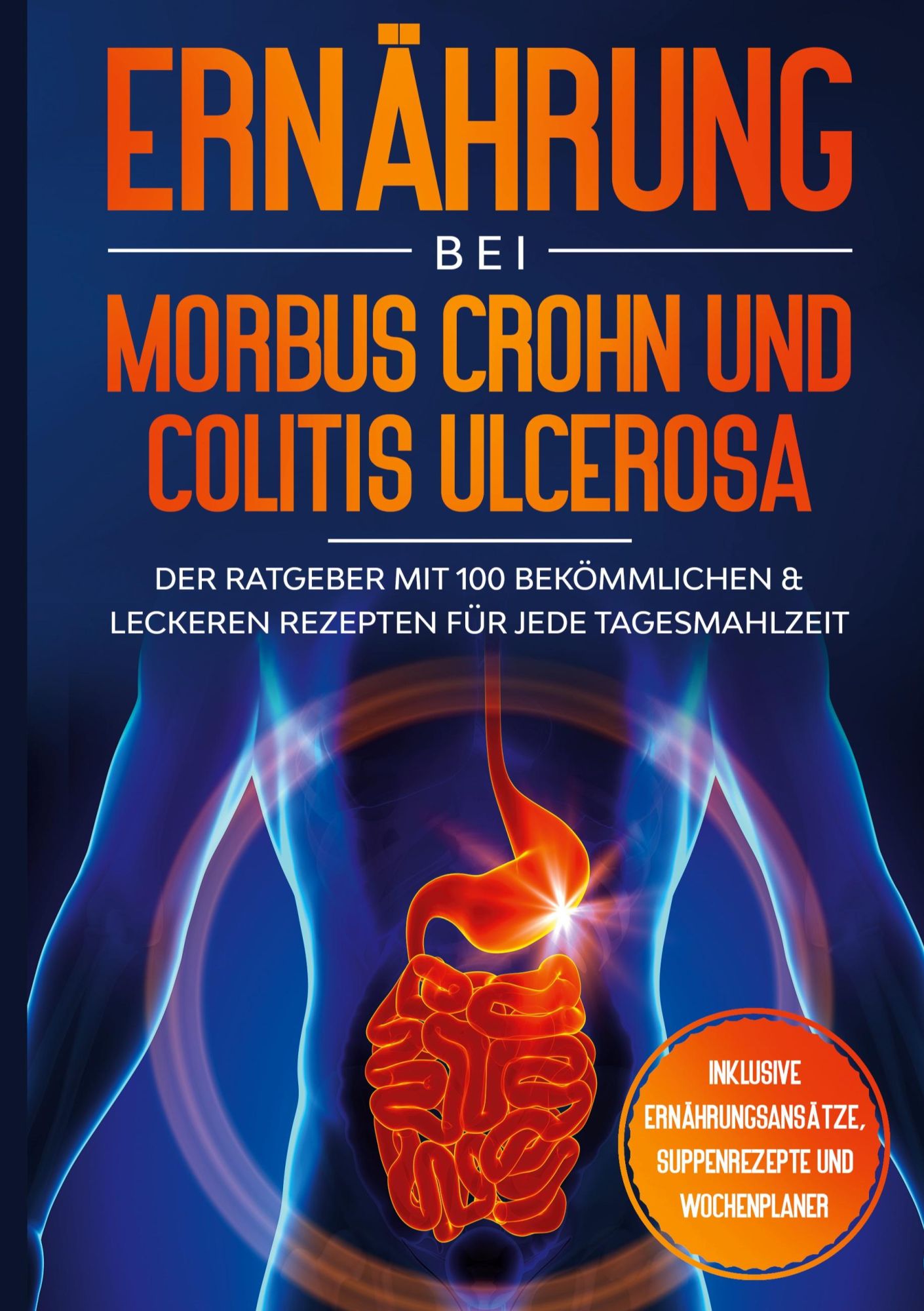 Cover: 9783755758600 | Ernährung bei Morbus Crohn und Colitis Ulcerosa: Der Ratgeber mit...