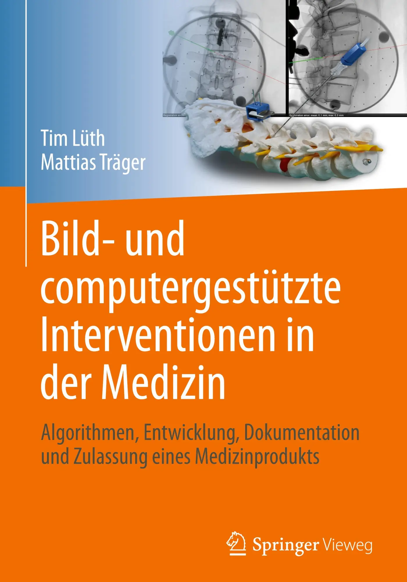 Cover: 9783662673201 | Bild- und computergestützte Interventionen in der Medizin | Buch | xiv Cover: 9783662673201 | Bild- und computergestützte Interventionen in der Medizin | Buch | xiv