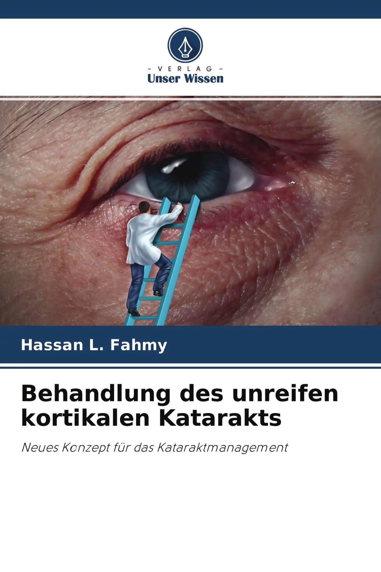 Cover: 9786204694801 | Behandlung des unreifen kortikalen Katarakts | Hassan L. Fahmy | Buch