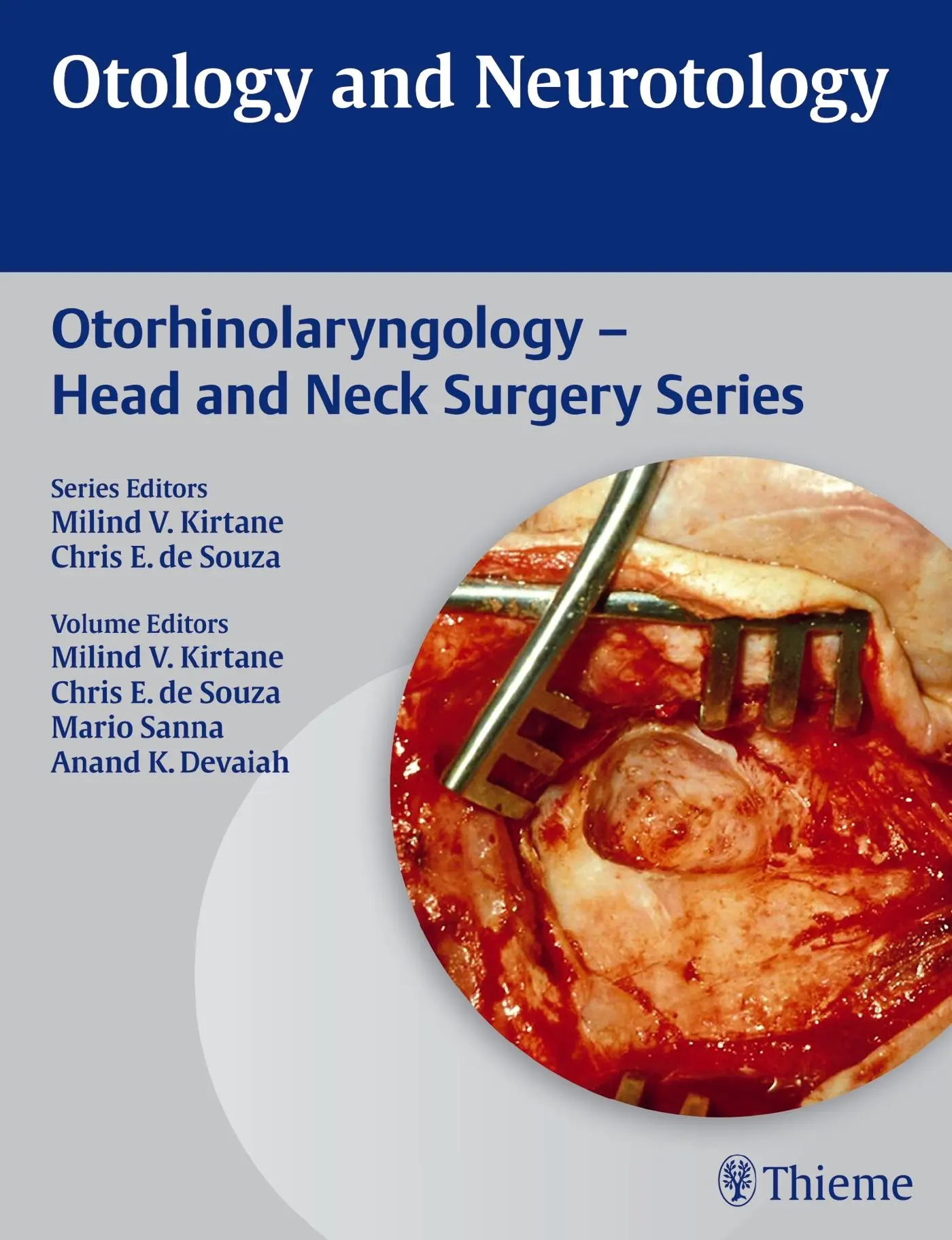 Cover: 9789382076001 | Otology and Neurotology | Mario Sanna (u. a.) | Buch | 520 S. | 2013