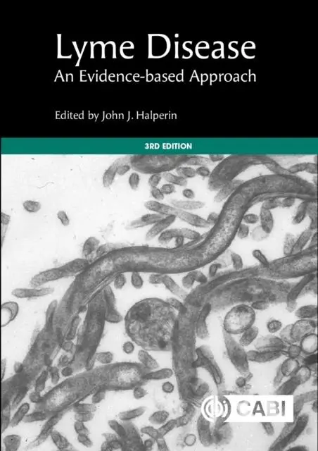 Cover: 9781800626201 | Lyme Disease | An Evidence-Based Approach | John Halperin | Buch