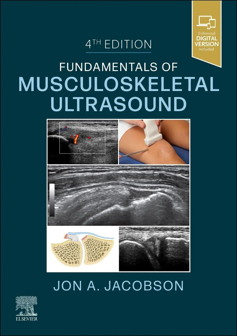 Cover: 9780323791502 | Fundamentals of Musculoskeletal Ultrasound | Jon A Jacobson | Buch