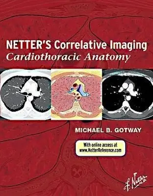 Cover: 9781437704402 | Netter's Correlative Imaging: Cardiothoracic Anatomy | Gotway | Buch