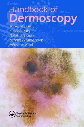 Cover: 9780415384902 | Handbook of Dermoscopy | Alfred W. Kopf (u. a.) | Taschenbuch | 2006