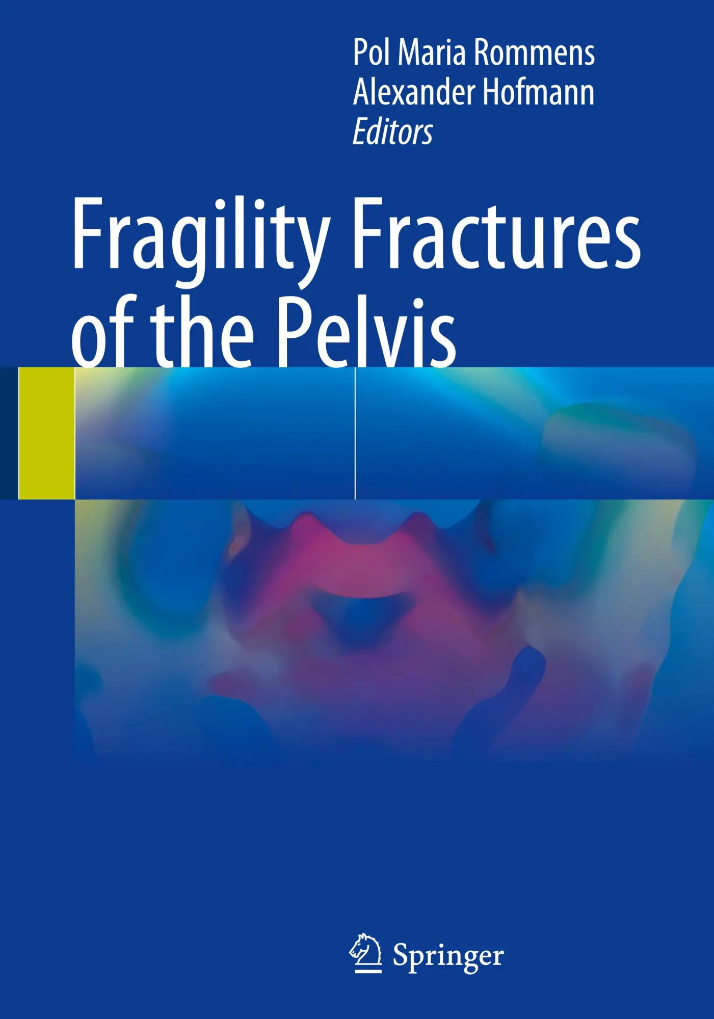 Cover: 9783319665702 | Fragility Fractures of the Pelvis | Alexander Hofmann (u. a.) | Buch