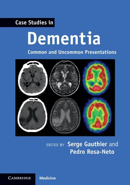 Cover: 9780521188302 | Case Studies in Dementia | Common and Uncommon Presentations | Buch