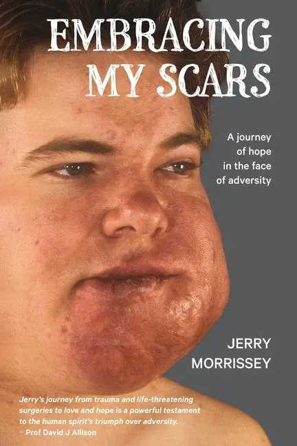 Cover: 9781763639102 | Embracing My Scars | A journey of hope in the face of adversity | Buch