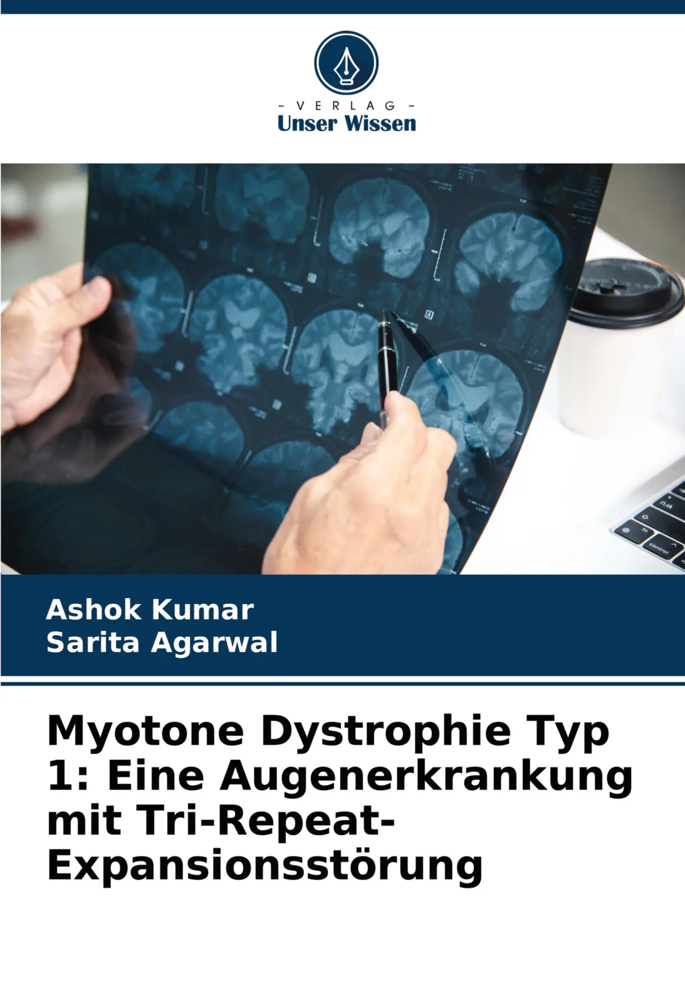 Cover: 9786208160203 | Myotone Dystrophie Typ 1: Eine Augenerkrankung mit...