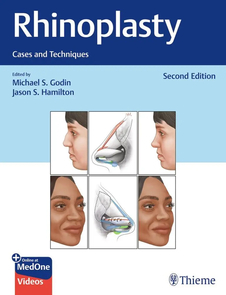 Cover: 9781684200603 | Rhinoplasty | Cases and Techniques | Michael S. Godin (u. a.) | Bundle