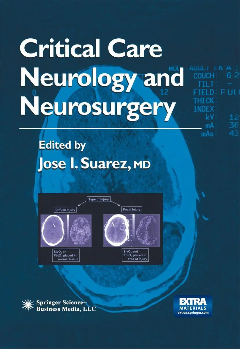 Cover: 9781617373503 | Critical Care Neurology and Neurosurgery | Jose I. Suarez | Buch | xv