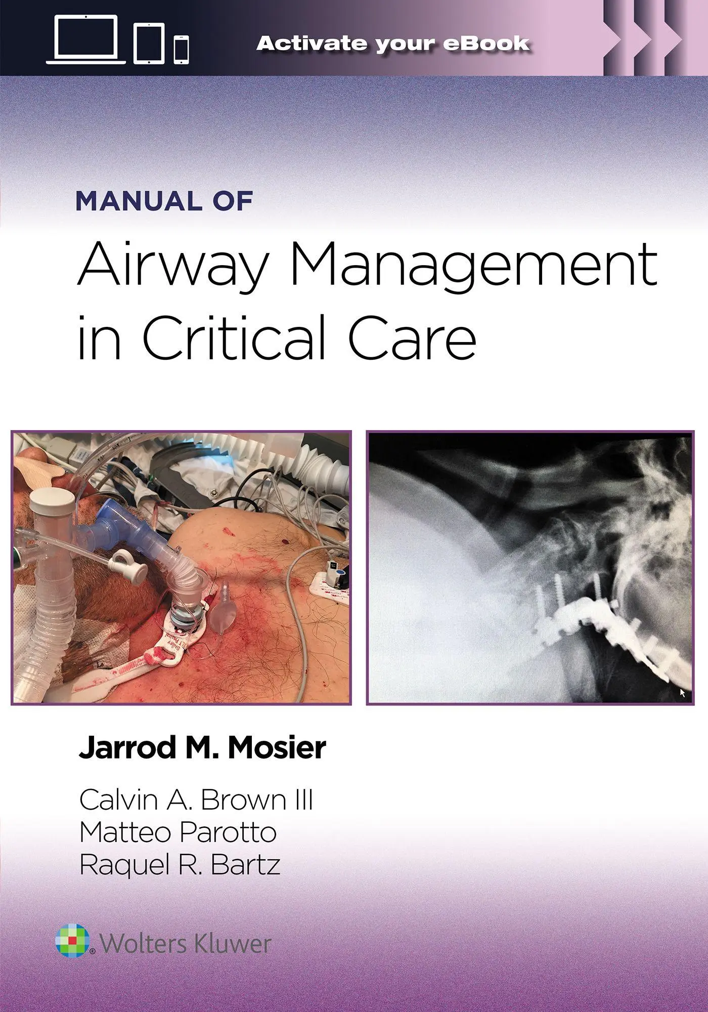 Cover: 9781975214203 | Manual of Airway Management in Critical Care | Jarrod Mosier (u. a.)