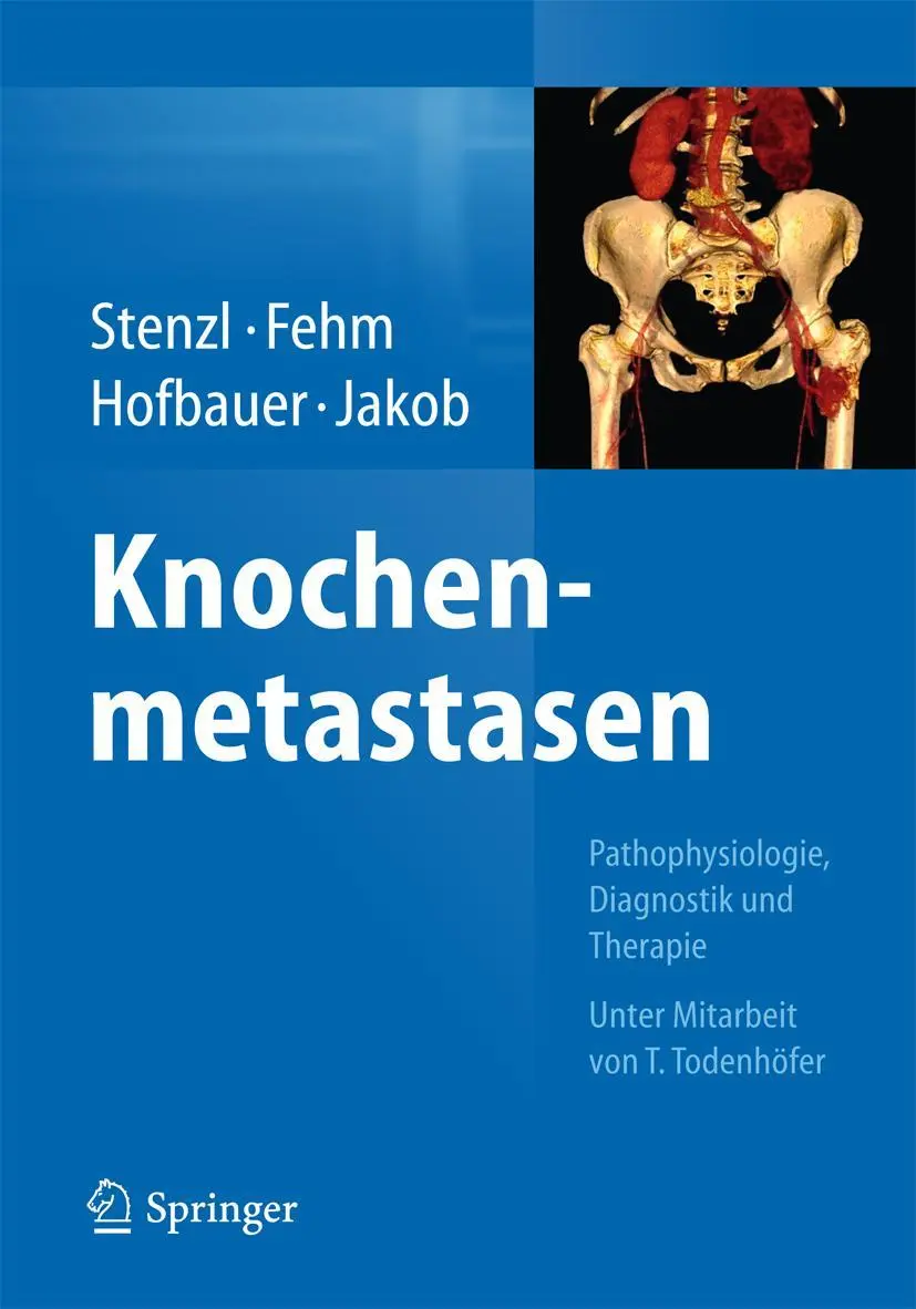 Cover: 9783662434703 | Knochenmetastasen | Arnulf Stenzl (u. a.) | Buch | xxii | Deutsch