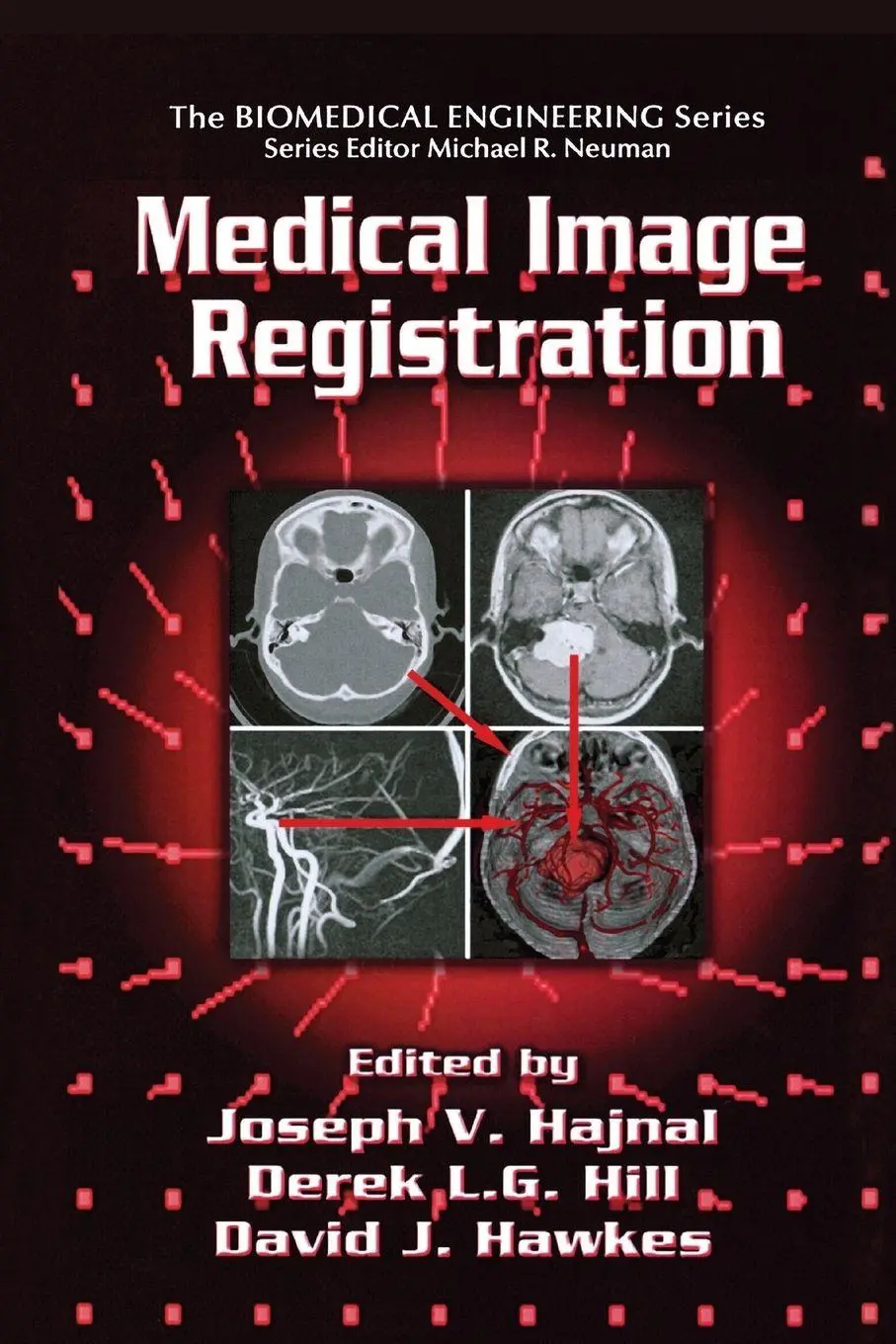 Cover: 9780367397203 | Medical Image Registration | Joseph V. Hajnal (u. a.) | Taschenbuch