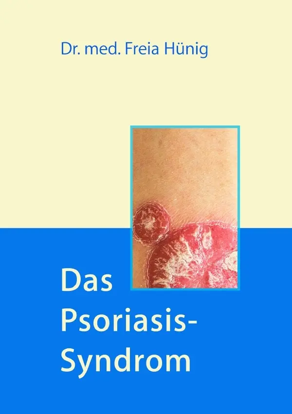 Cover: 9783745088403 | Das Psoriasis-Syndrom | Freia Hünig | Taschenbuch | 176 S. | Deutsch