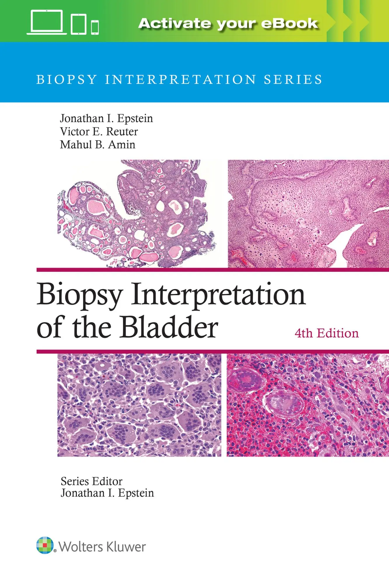 Cover: 9781975199203 | Biopsy Interpretation of the Bladder: Print + eBook with Multimedia