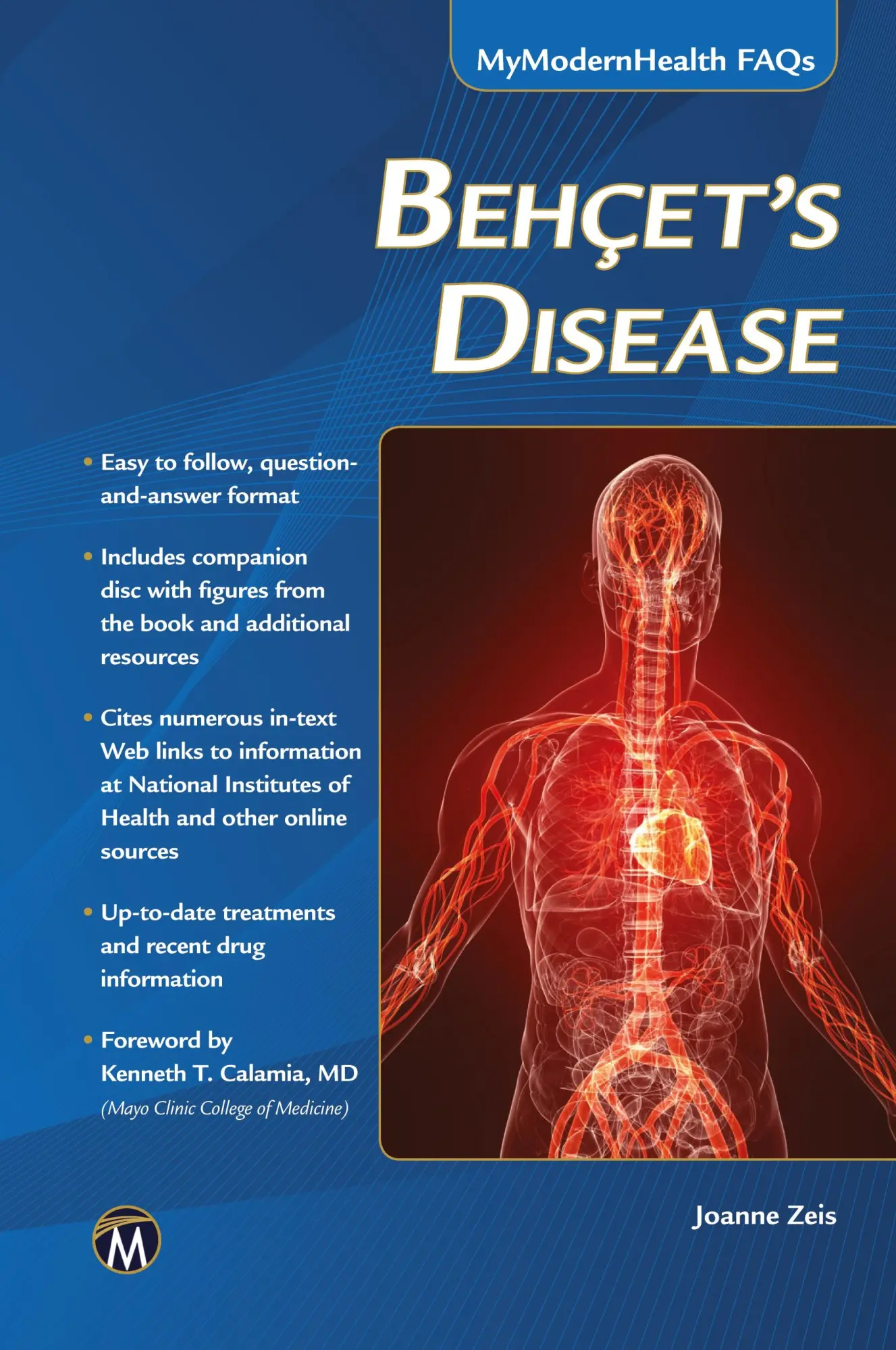 Cover: 9781938549403 | Behcet's Disease | Joanne Zeis | Taschenbuch | Englisch | 2014