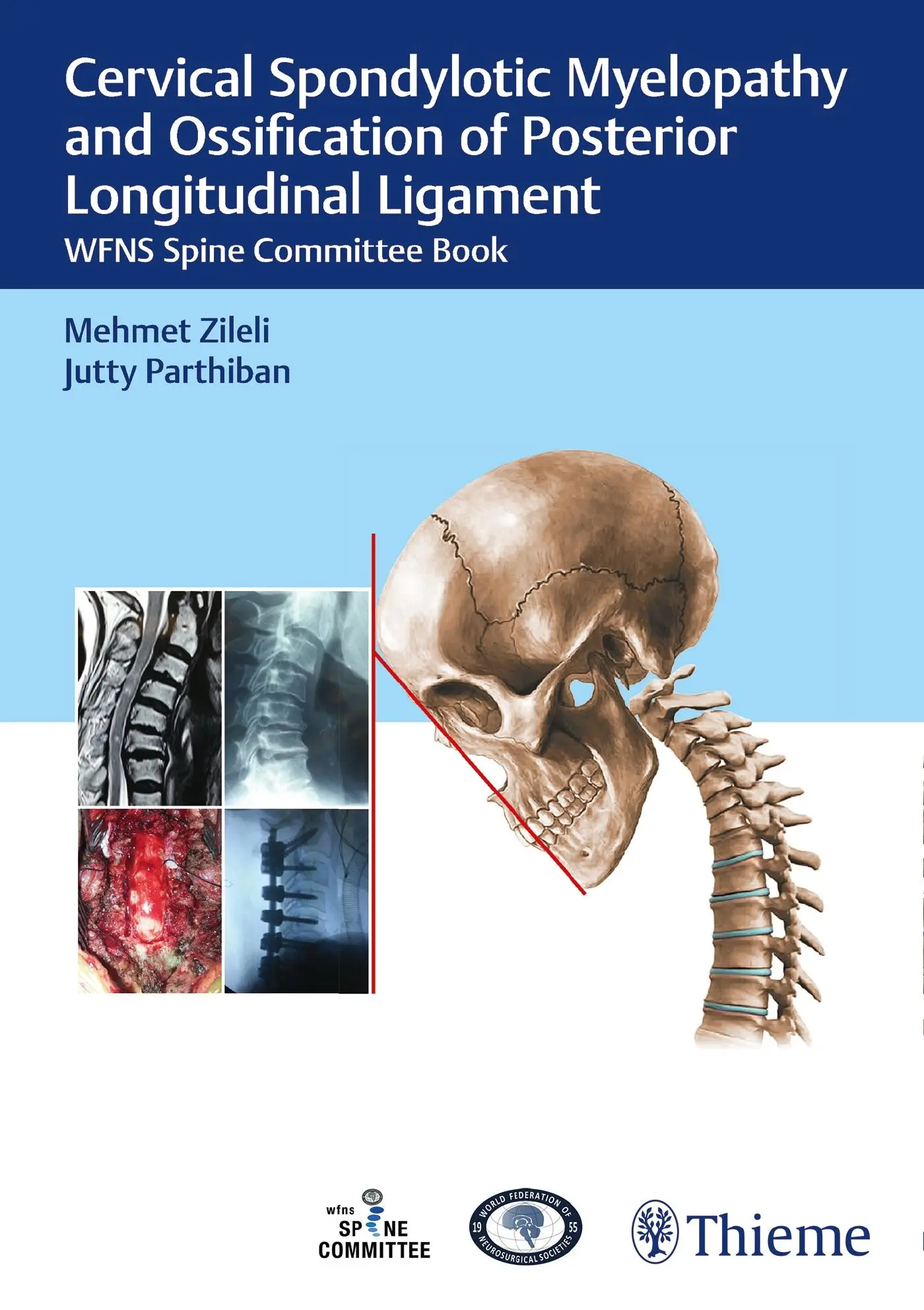 Cover: 9789390553204 | Cervical Spondylotic Myelopathy and Ossification of Posterior...