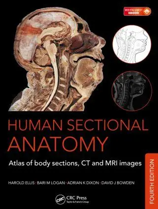 Cover: 9781498703604 | Human Sectional Anatomy | Adrian K Dixon (u. a.) | Buch | Englisch