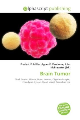 Brain Tumor | Frederic P. Miller (u. a.) | Taschenbuch | Englisch | Alphascript Publishing | EAN 9786130298104 - Miller, Frederic P.