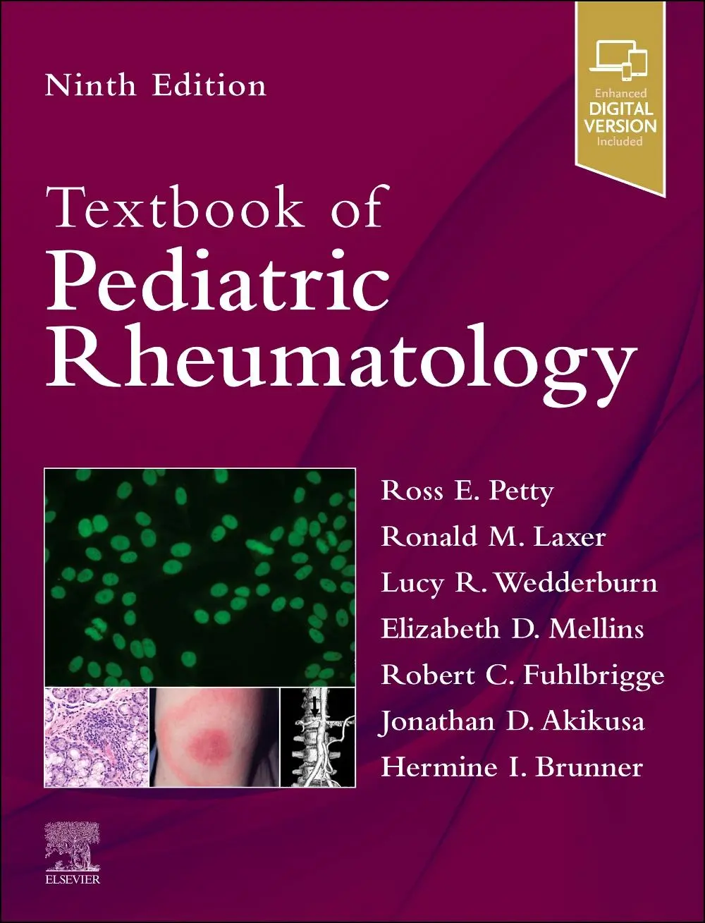 Cover: 9780443119804 | Textbook of Pediatric Rheumatology | Ross E Petty (u. a.) | Buch
