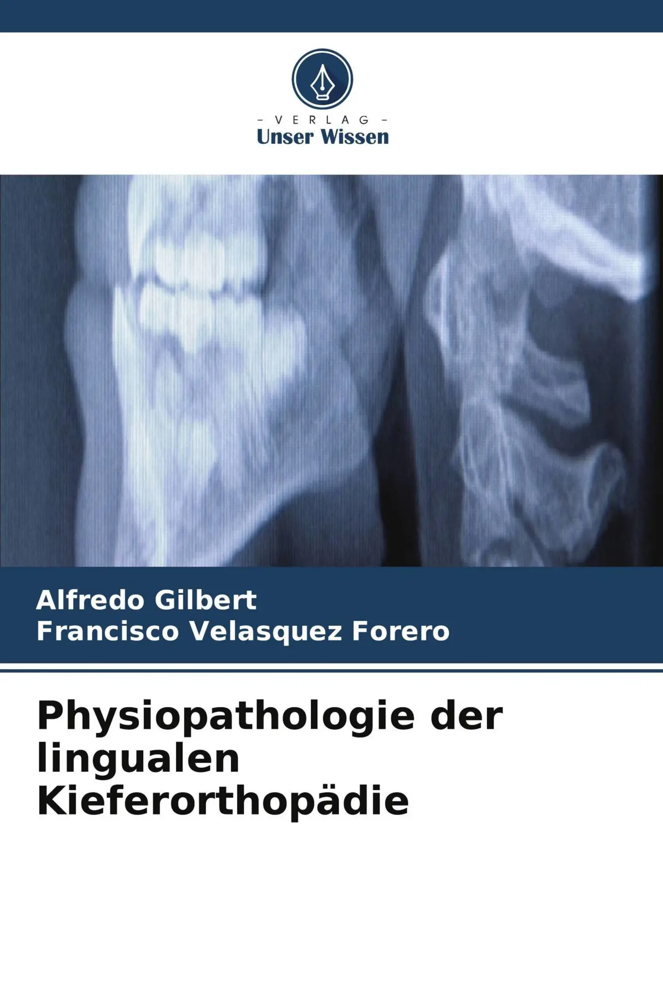 Cover: 9786630284805 | Physiopathologie der lingualen Kieferorthopädie | Gilbert (u. a.)