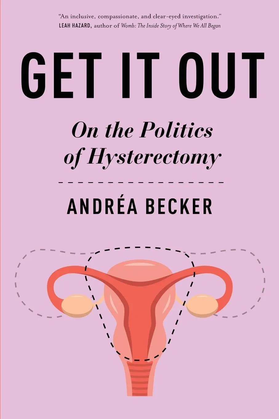Cover: 9781479826605 | Get It Out | On the Politics of Hysterectomy | Andréa Becker | Buch Cover: 9781479826605 | Get It Out | On the Politics of Hysterectomy | Andréa Becker | Buch