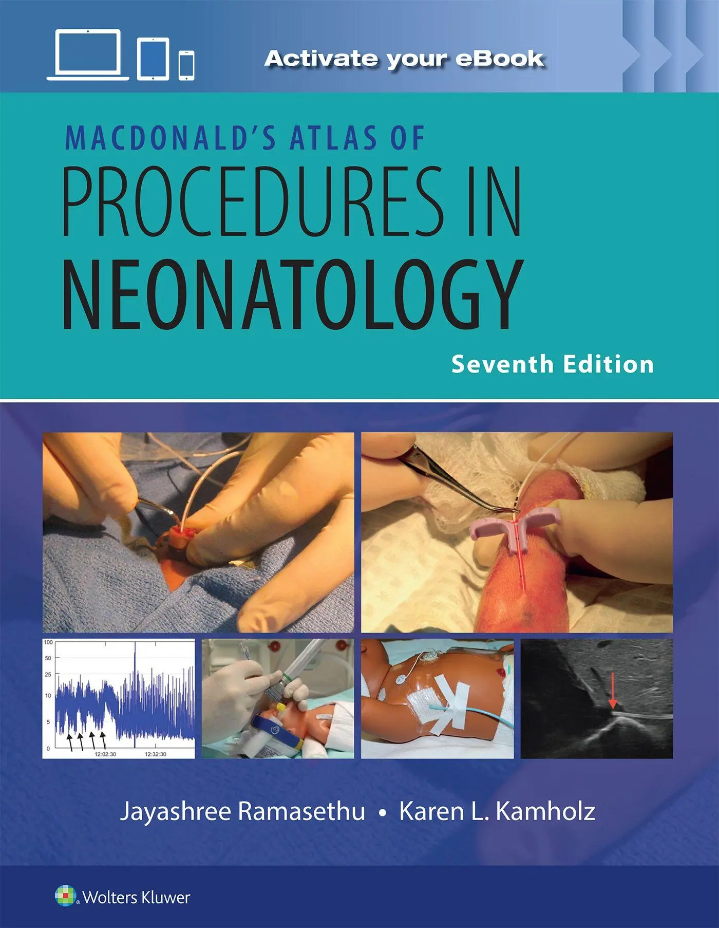 Cover: 9781975237905 | MacDonald's Atlas of Procedures in Neonatology Print + eBook with...