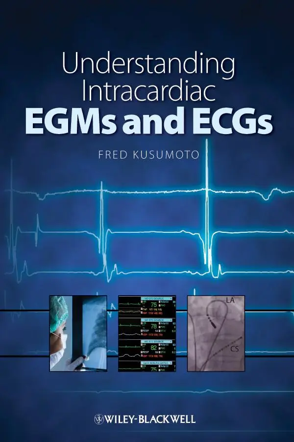 Cover: 9781405184106 | Understanding Intracardiac EGMs and ECGs | Fred M Kusumoto | Buch