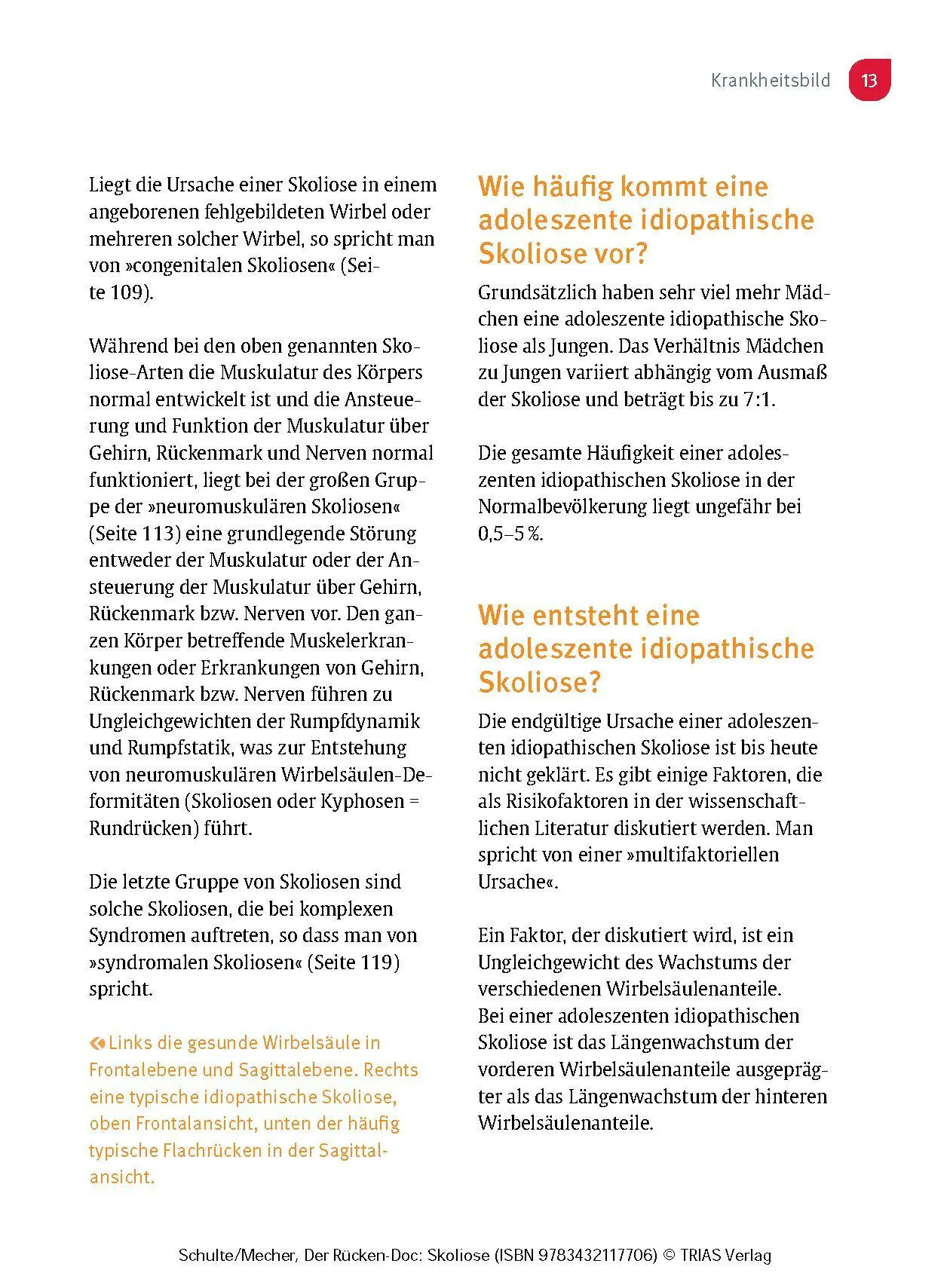Bild: 9783432117706 | Der Rücken-Doc: Skoliose | Tobias L. Schulte (u. a.) | Taschenbuch