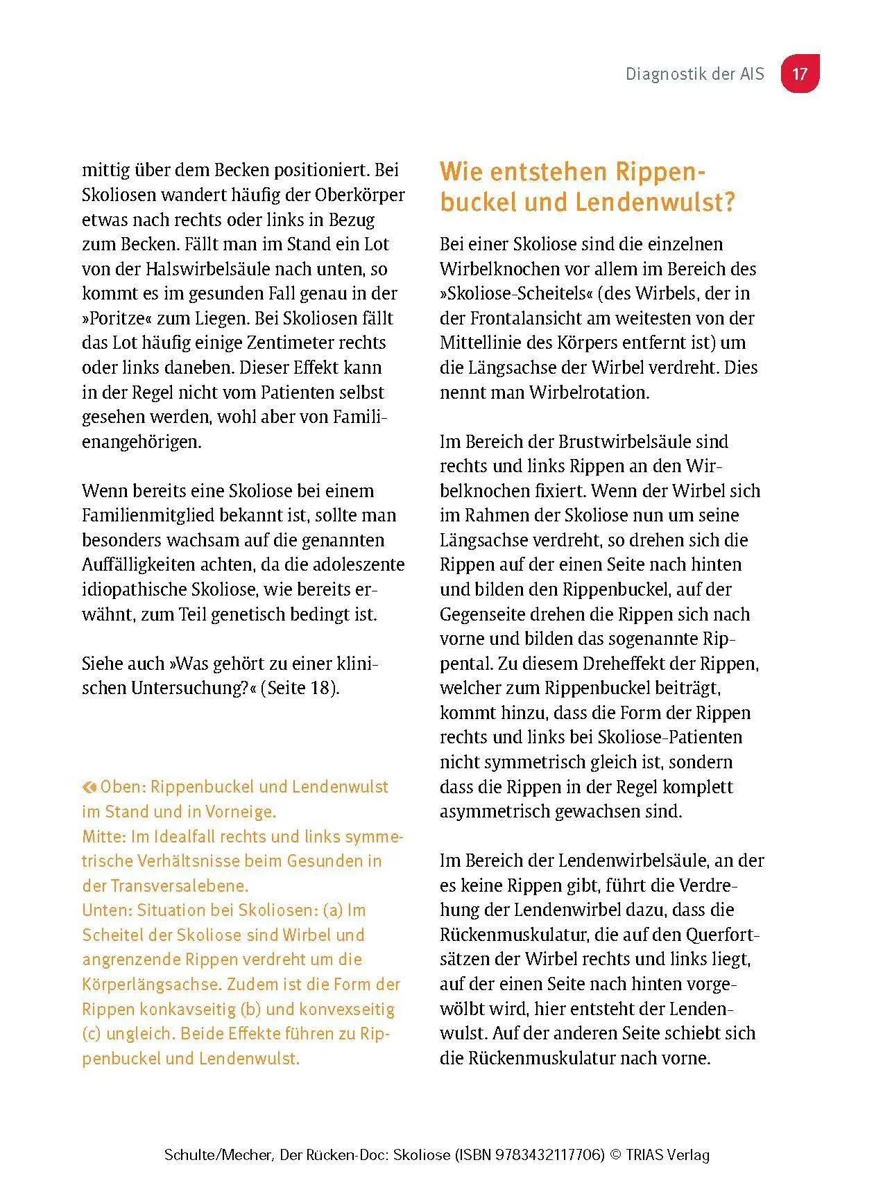 Bild: 9783432117706 | Der Rücken-Doc: Skoliose | Tobias L. Schulte (u. a.) | Taschenbuch