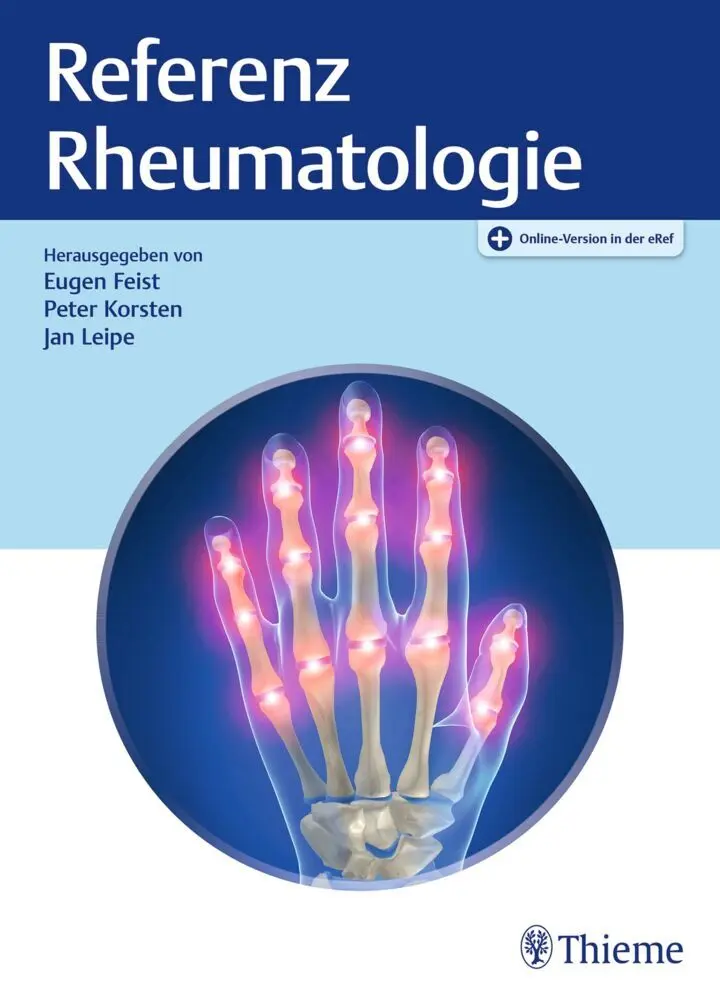 Cover: 9783132437906 | Referenz Rheumatologie | Eugen Feist (u. a.) | Bundle | 1 eBook | 2026
