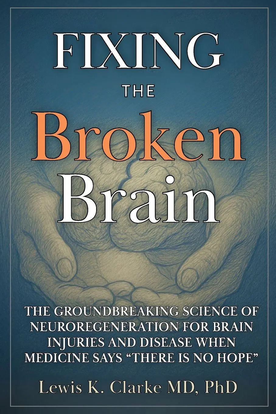 Cover: 9798895978306 | Fixing the Broken Brain | Lewis Clarke | Taschenbuch | Englisch | 2026