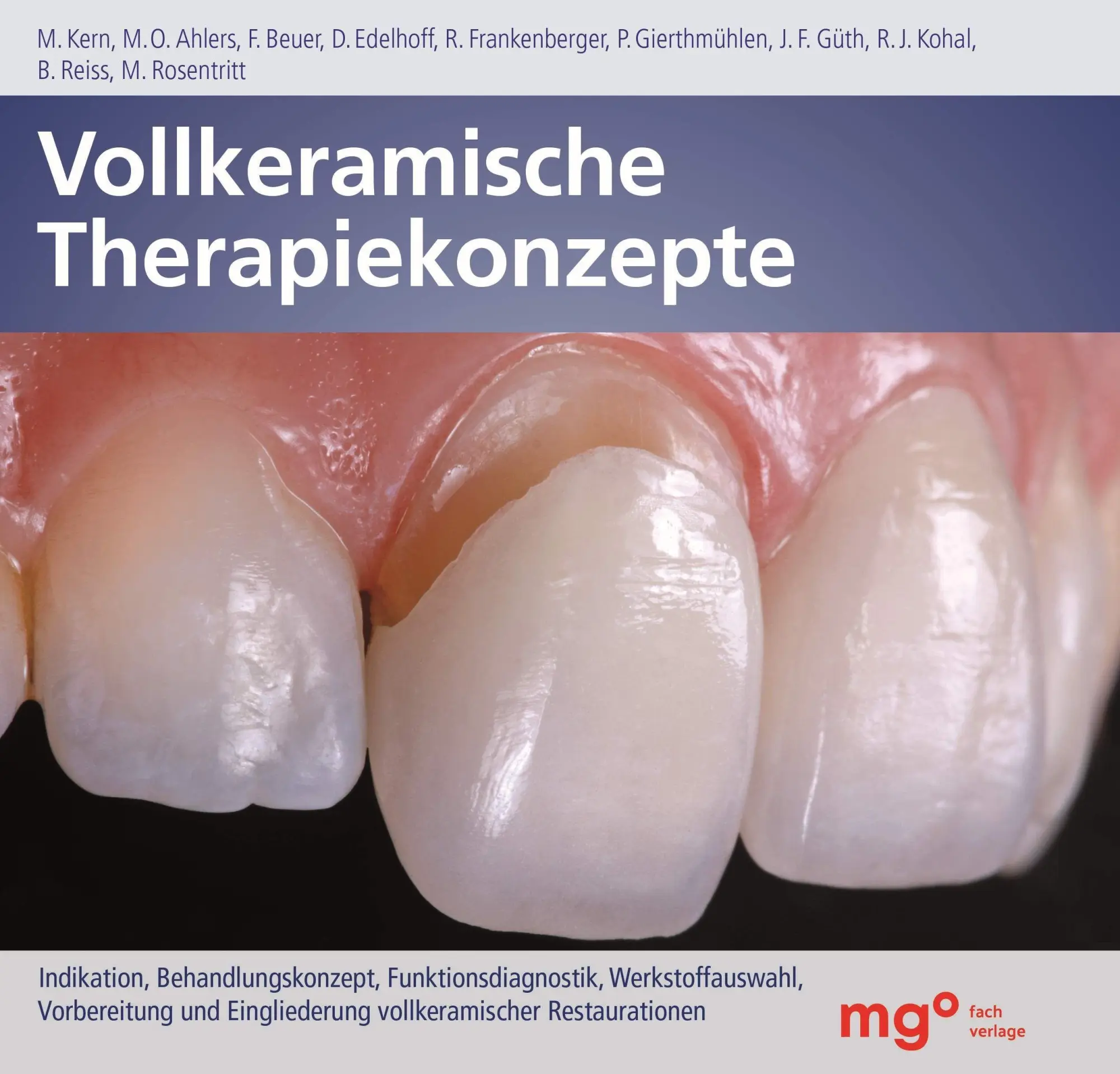 Cover: 9783964748706 | Vollkeramische Therapiekonzepte | Matthias Kern (u. a.) | Buch | 2026