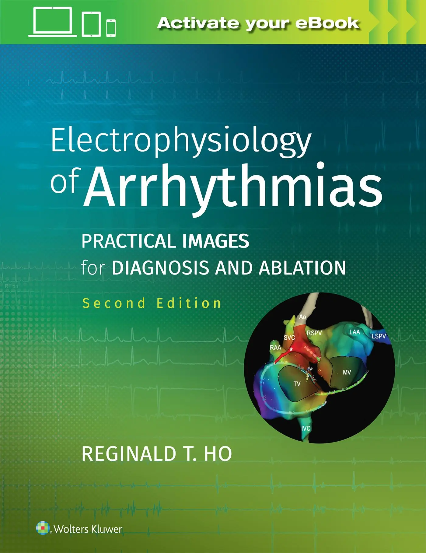 Cover: 9781975101107 | Electrophysiology of Arrhythmias | Reginald T. Ho | Buch | Gebunden