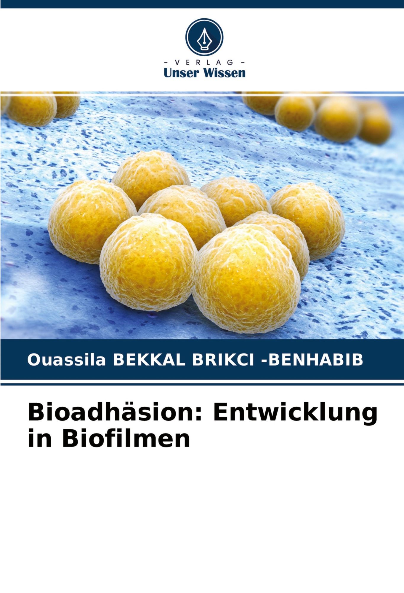 Cover: 9786204371207 | Bioadhäsion: Entwicklung in Biofilmen | -Benhabib | Taschenbuch | 2021