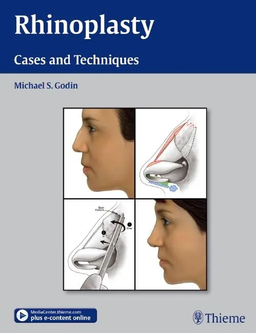 Cover: 9781604066807 | Rhinoplasty | Cases and Techniques | Michael S Godin | Buch | Englisch