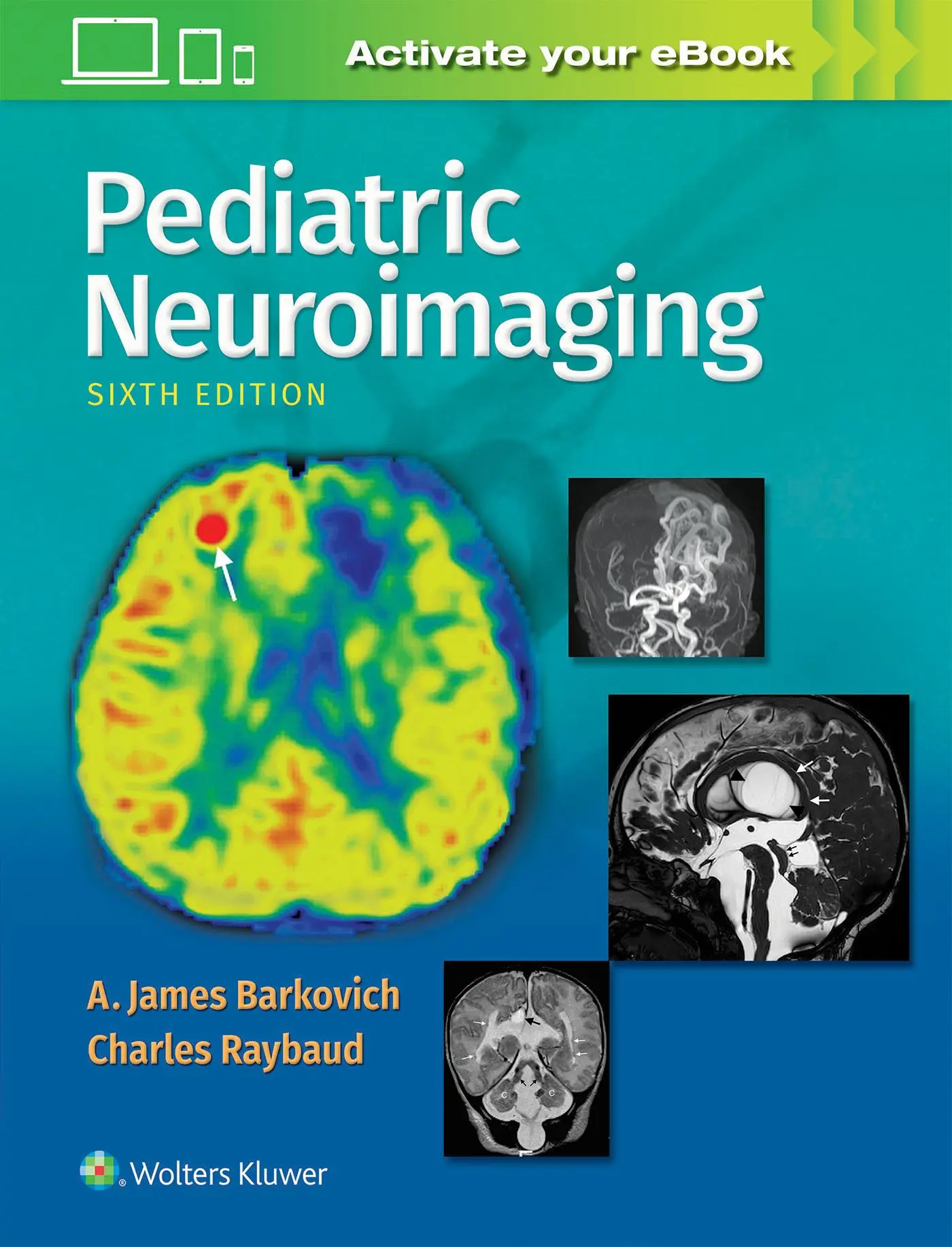 Cover: 9781496337207 | Pediatric Neuroimaging | A. James Barkovich | Buch | Englisch | 2018