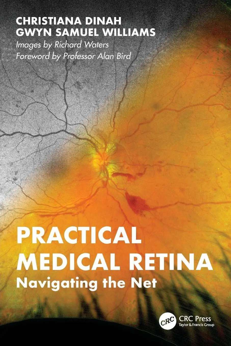 Cover: 9781041044208 | Practical Medical Retina | Navigating the Net | Dinah (u. a.) | Buch