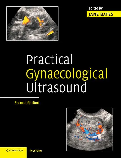 Cover: 9780521674508 | Practical Gynaecological Ultrasound | Jane Bates | Taschenbuch | 2014