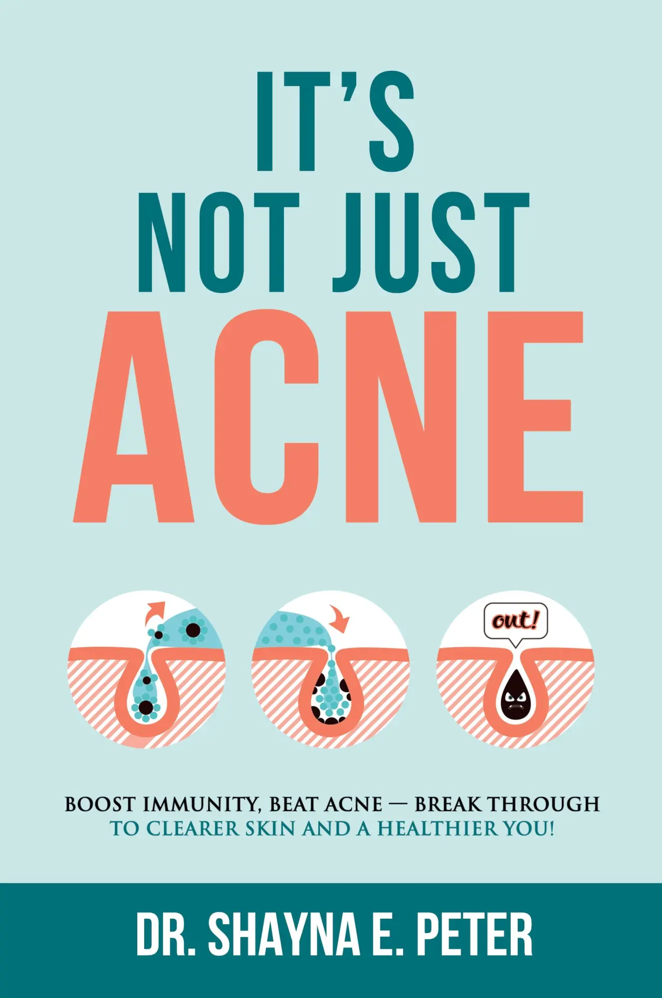 Cover: 9781735465708 | It's Not Just Acne | Shayna E Peter | Taschenbuch | Englisch | 2020